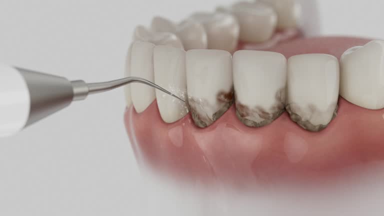 Reliable Dental Implants contractor in Polk County County, AR by Dentist Open Now